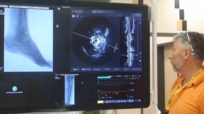 VIDEO: Kladenská nemocnice disponuje novou moderní angiolinkou