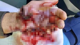 Sedm zraněn&yacute;ch od pyrotechniky v kraji